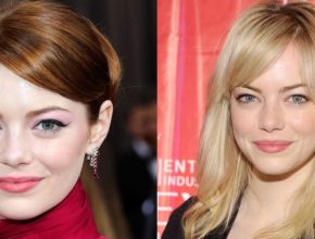 Emma Stone before and after plastic surgery 35