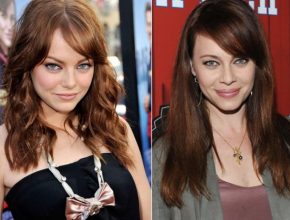 Emma Stone before and after plastic surgery 5
