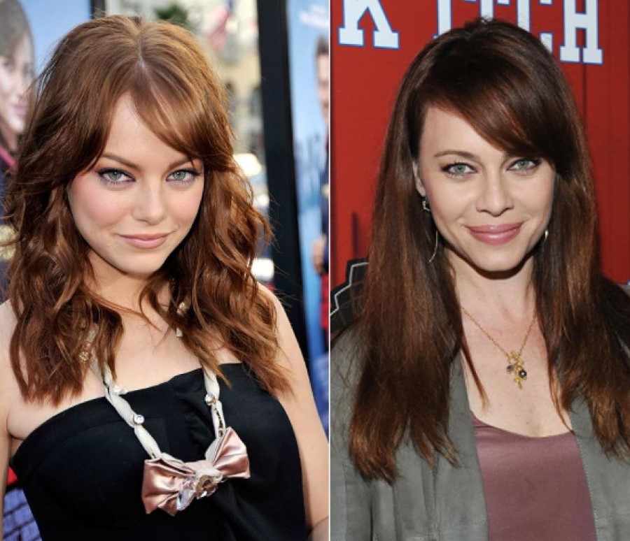 Emma Stone before and after plastic surgery 5.
