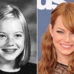 Emma Stone before and after plastic surgery 6