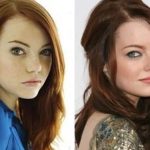 Emma Stone before and after plastic surgery 8