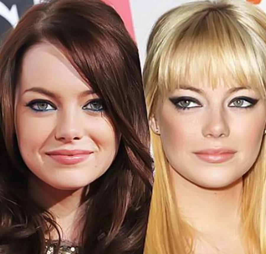 Emma Stone Before And After