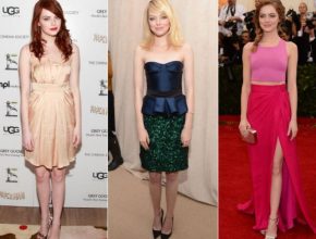 Emma Stone plastic surgery 12