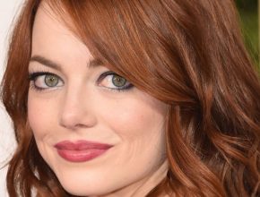 Emma Stone plastic surgery 17
