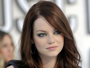 Emma Stone plastic surgery 19