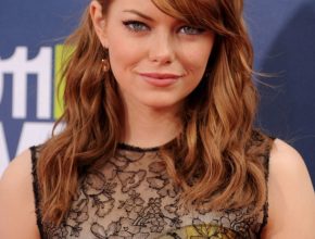 Emma Stone plastic surgery 21