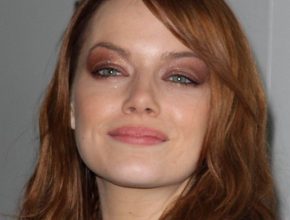 Emma Stone plastic surgery 22