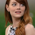 Emma Stone plastic surgery 24