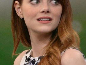 Emma Stone plastic surgery 24