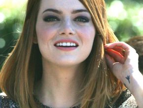 Emma Stone plastic surgery 28