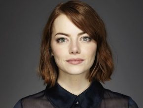 Emma Stone plastic surgery 32