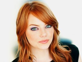 Emma Stone plastic surgery 33