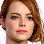 Emma Stone plastic surgery 36