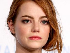 Emma Stone plastic surgery 36