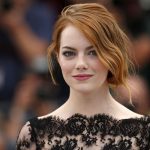 Emma Stone plastic surgery 37