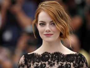 Emma Stone plastic surgery 37