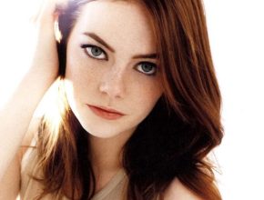 Emma Stone plastic surgery 4