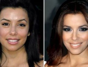 Eva Longoria before and after plastic surgery 39