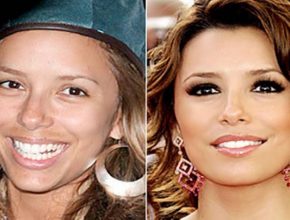 Eva Longoria before and after plastic surgery 4