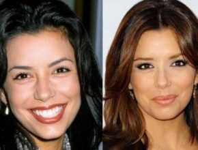 Eva Longoria before and after plastic surgery 42