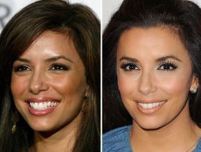 Eva Longoria before and after plastic surgery 46