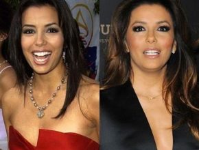 Eva Longoria before and after plastic surgery 47