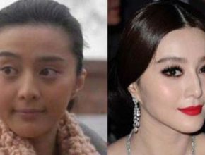 Fan Bingbing before and after plastic surgery