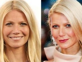 Gwyneth Paltrow before and after plastic surgery 1