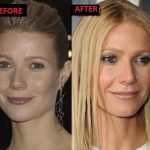 Gwyneth Paltrow before and after plastic surgery 2