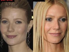 Gwyneth Paltrow before and after plastic surgery 2