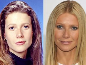 Gwyneth Paltrow before and after plastic surgery