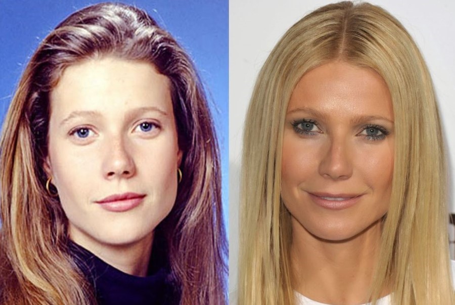 Gwyneth Paltrow before and after plastic surgery 