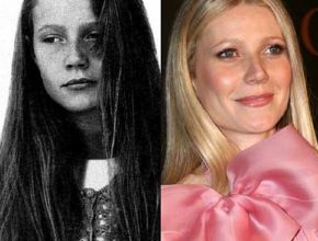 Gwyneth Paltrow before and after plastic surgery