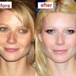 Gwyneth Paltrow before and after plastic surgery 3