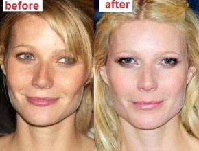 Gwyneth Paltrow before and after plastic surgery 3