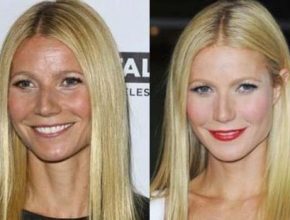 Gwyneth Paltrow before and after plastic surgery 4