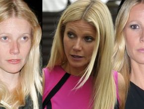 Gwyneth Paltrow before and after plastic surgery 48