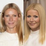 Gwyneth Paltrow before and after plastic surgery 7