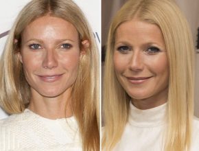 Gwyneth Paltrow before and after plastic surgery 7