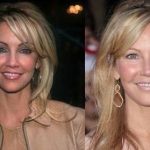 Heather Locklear before and after plastic surgery 7