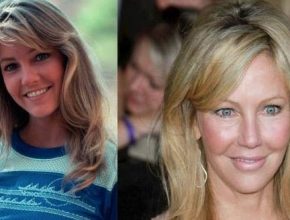Heather Locklear before and after plastic surgery 8