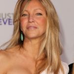 Heather Locklear plastic surgery 24