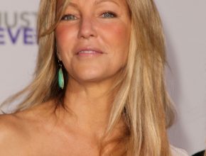 Heather Locklear plastic surgery 24