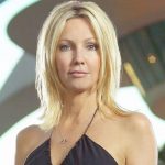 Heather Locklear plastic surgery 25