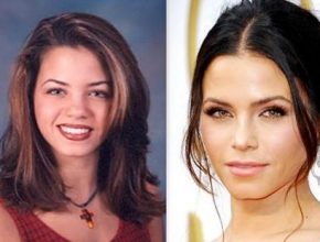 Jenna Dewan plastic surgery 11