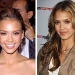 Jessica Alba before and after plastic surgery 11