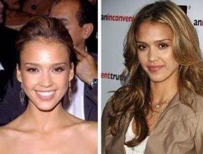 Jessica Alba before and after plastic surgery 11