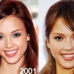 Jessica Alba before and after plastic surgery 31