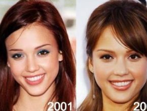 Jessica Alba before and after plastic surgery 31