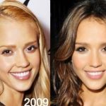 Jessica Alba before and after plastic surgery 32